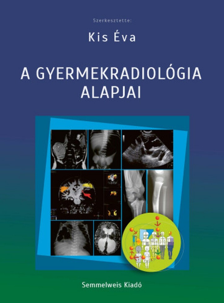 A Gyermekradiológia Alapjai (2025)